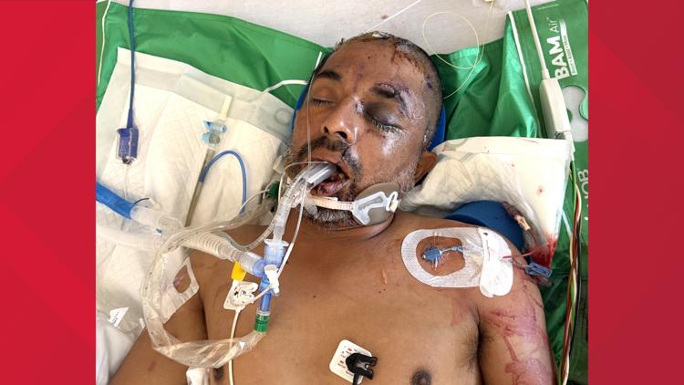 University Hospital asks for help identifying unconscious patient hit by truck Saturday evening — KENS 5 (San Antonio), Golden Valley Health news