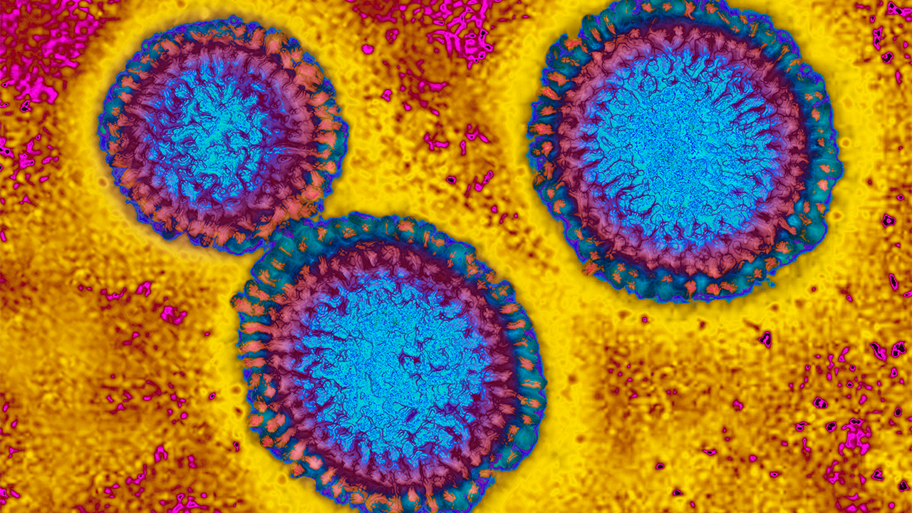 Flu hospitalizations 'slightly higher' than usual, officials urge vaccinations — FOX 9, Golden Valley Health news